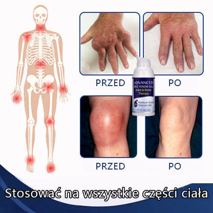 Advanced™ Żel Terapeutyczny na Stawy i Kości z Jadem Pszczelim (dla chorób ortopedycznych i bólu stawów)