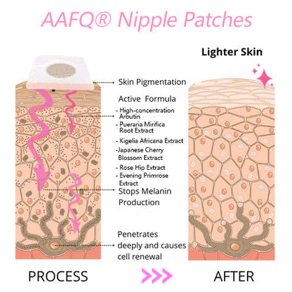 Plastry na brodawki AAFQ® Plump up & Tighten Skin & Soft & Pinkfy